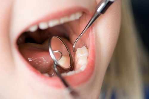 5 Reasons your Child needs regular Dental Check-ups 