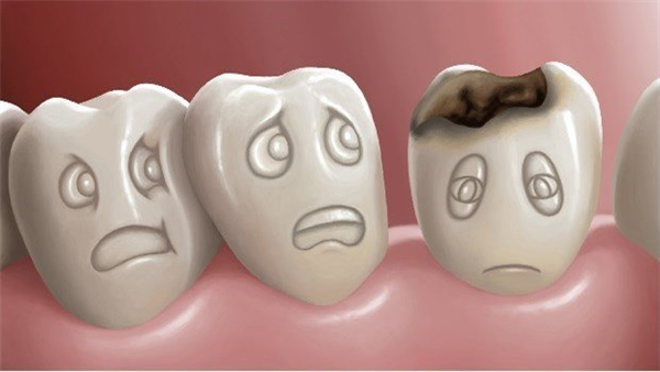 Toothache - The Causes, Symptoms and Treatments 