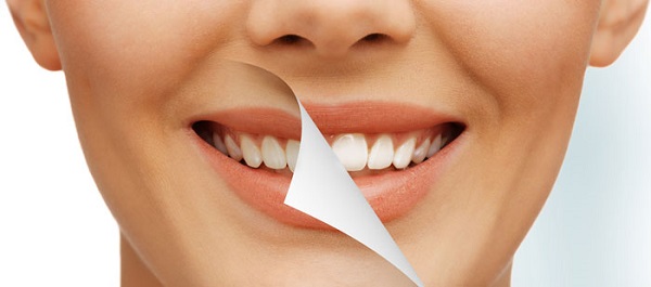 Teeth Whitening at a Claremont Dentist