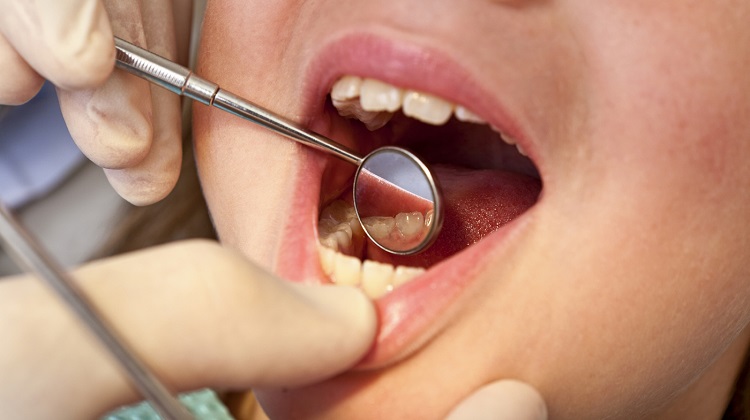 Dental checkups for children - Dentist in Claremont