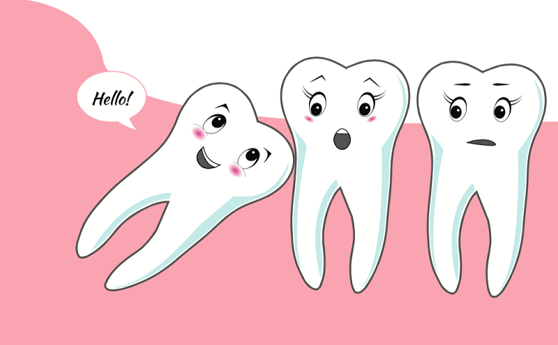 Wisdom tooth removal - Dentist in Claremont, Cape Town